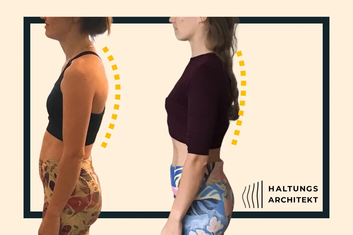 Person mit Hohlkreuz und vorgeneigtem Nacken