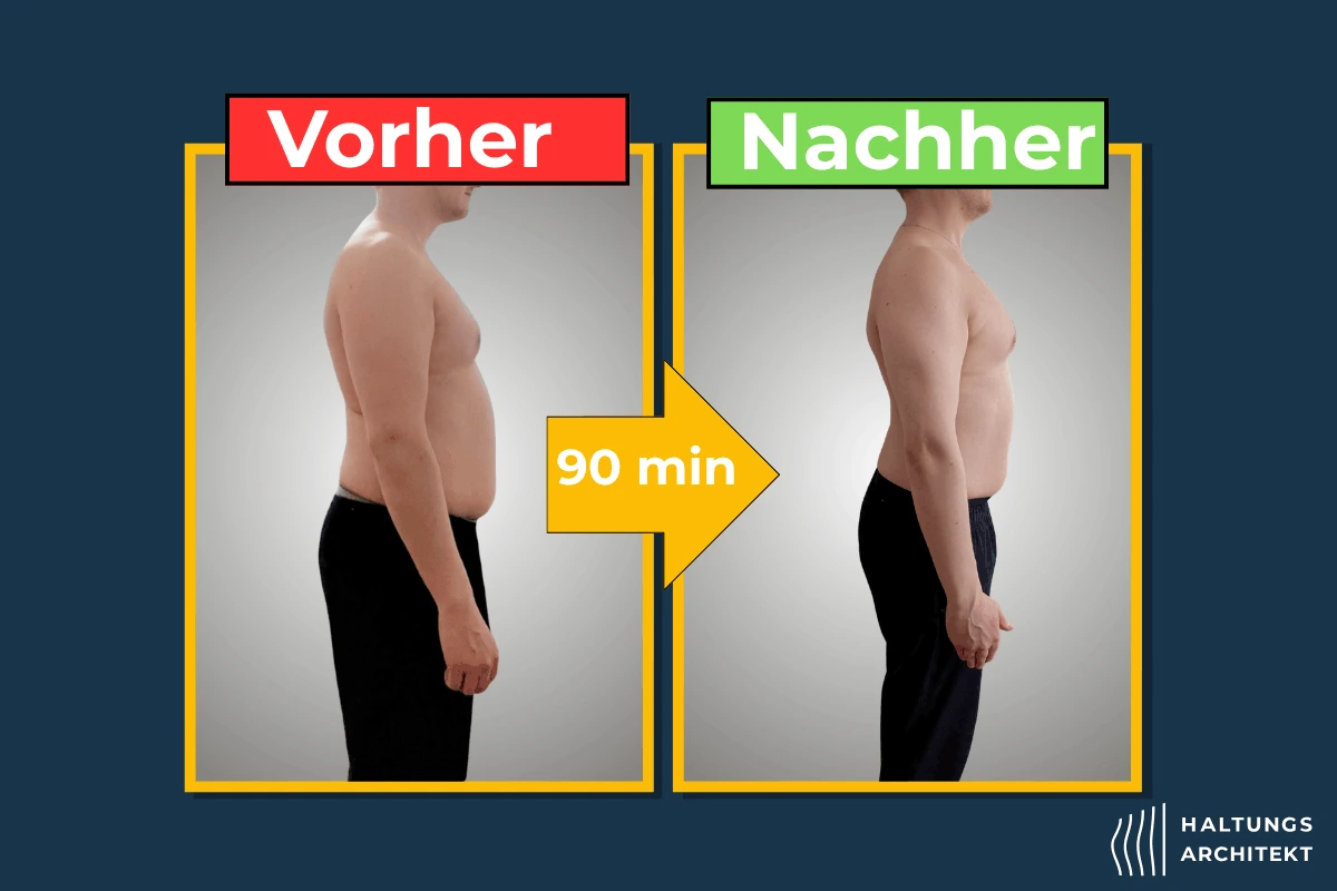 Person mit Hohlkreuz und vorgeneigtem Nacken