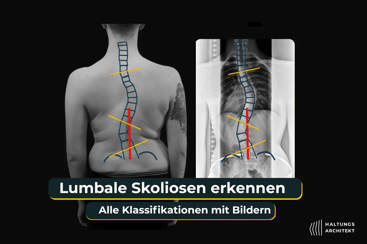 Person mit Hohlkreuz und vorgeneigtem Nacken
