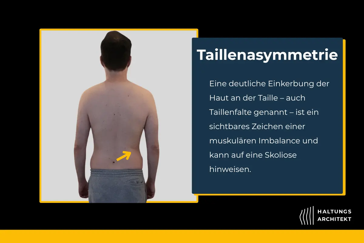 Test zum Erkennen einer Skoliose: Taillenasymmetrie überprüfen