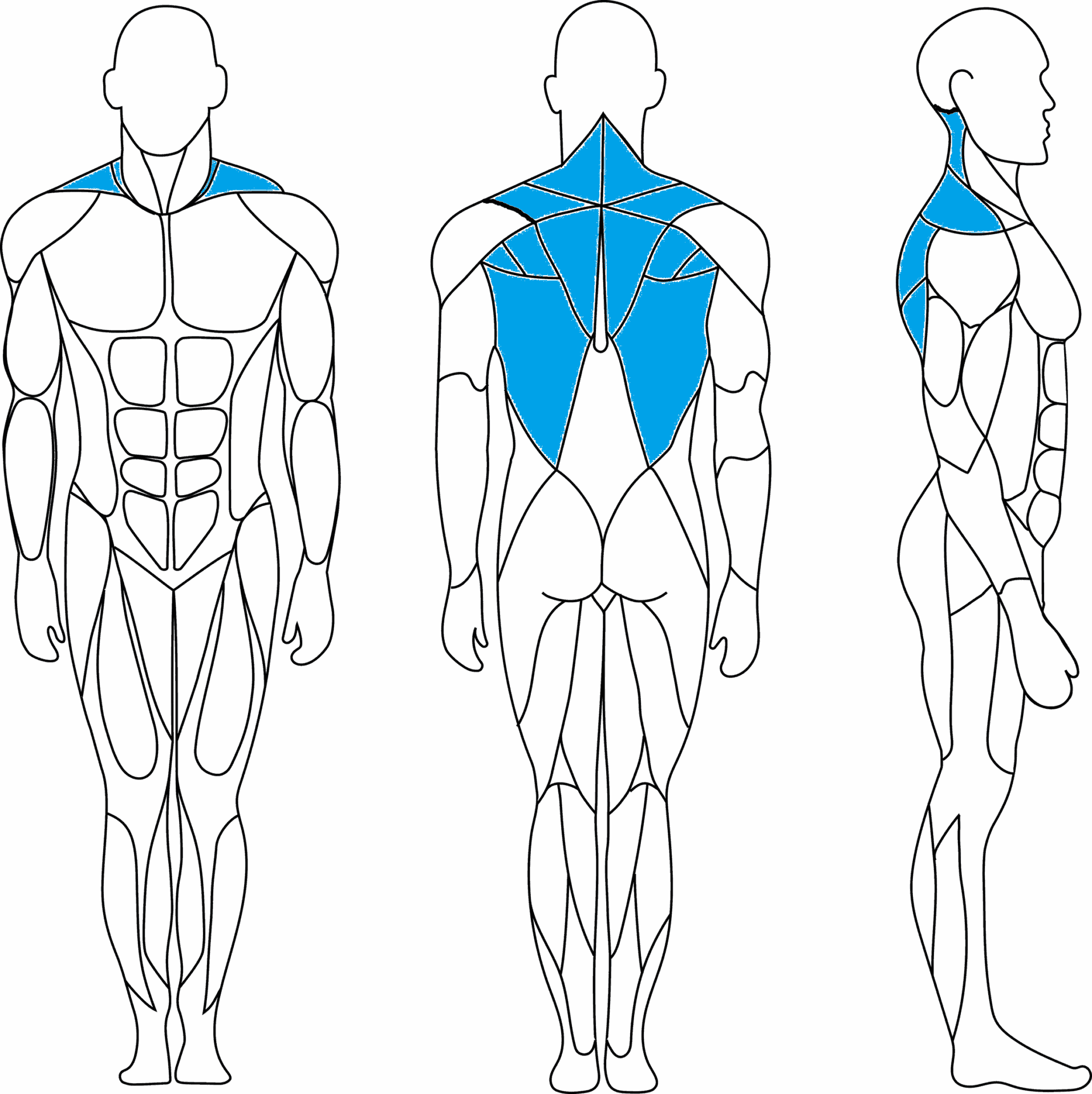 Überdehnte Muskeln bei einem Rundrücken